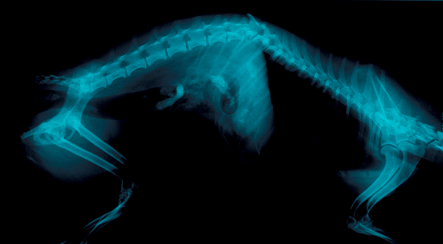 X-ray of spinal fracture